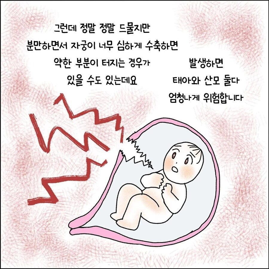산부인과에서 출산 중 자궁파열 되는 만화.jpg - 이미지 3