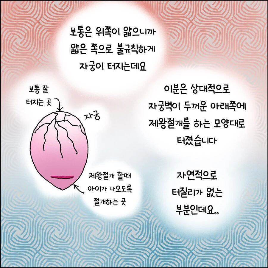 산부인과에서 출산 중 자궁파열 되는 만화.jpg - 이미지 8