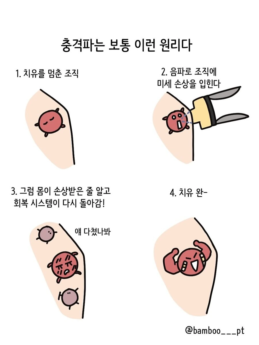 충격파 치료 받는 환자 유형.manwha - 이미지 3