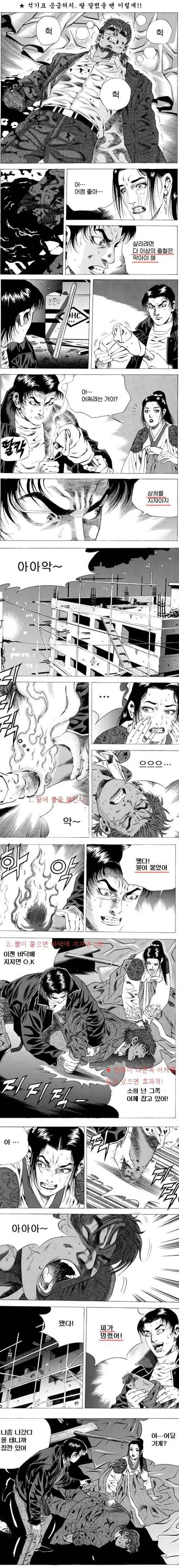 자상, 출열이 심할때 응급처치하는 manga