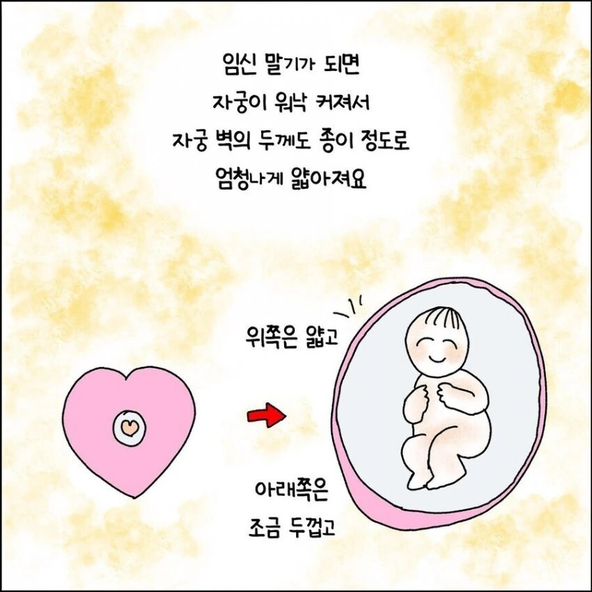산부인과에서 출산 중 자궁이 파열되는 만화.manhwa - 이미지 2