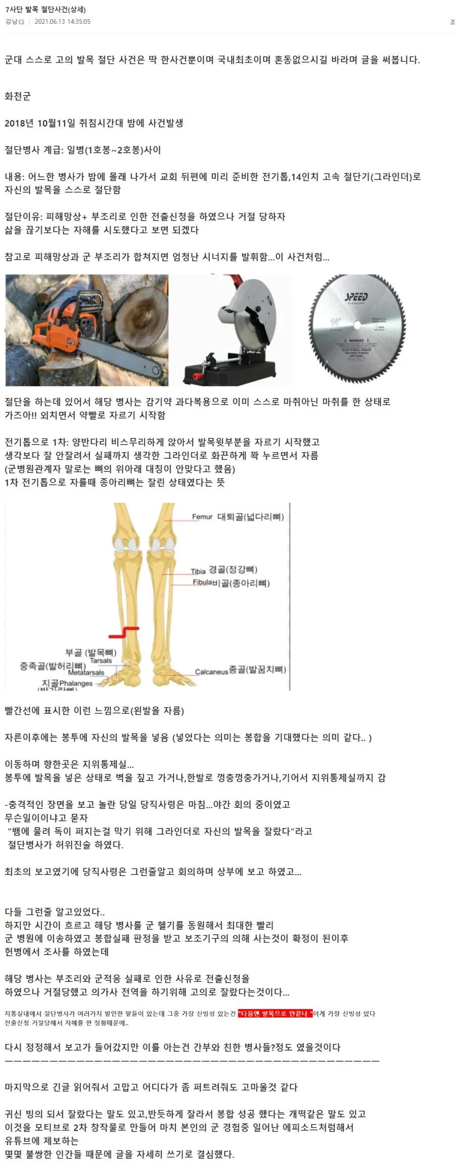 스스로 자기 발목 자른 군인 썰.manhwa - 이미지 4