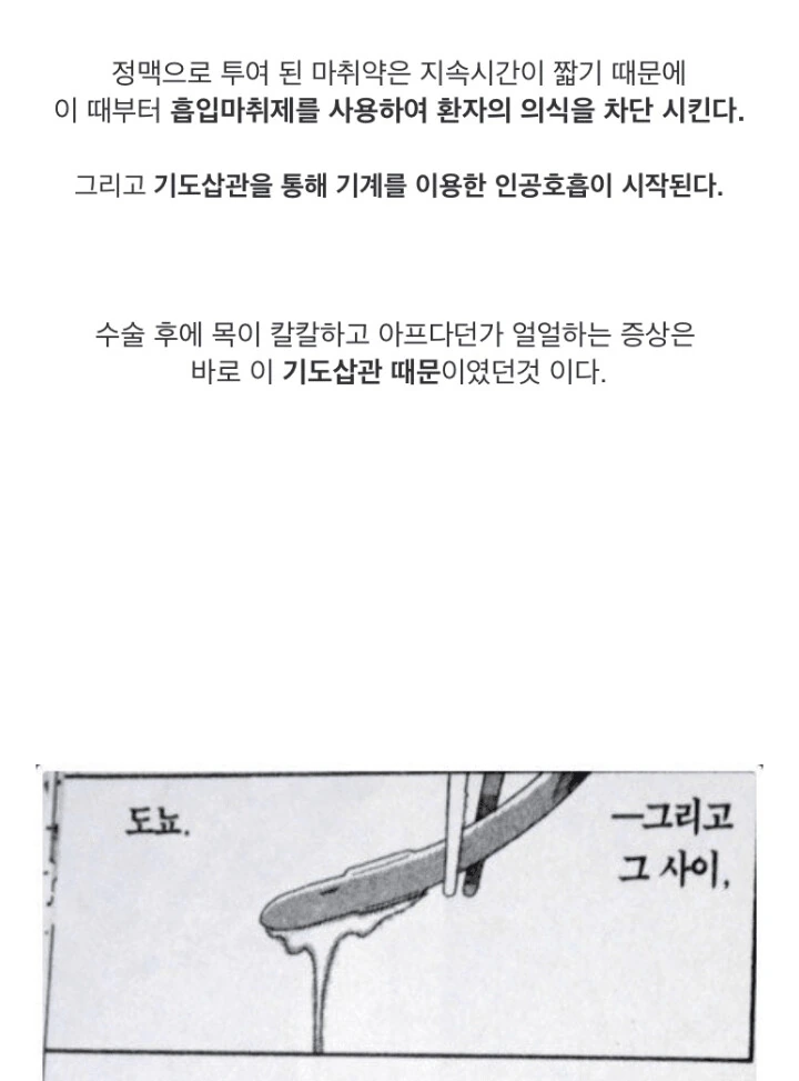 전신마취 알려주는.manga - 이미지 11