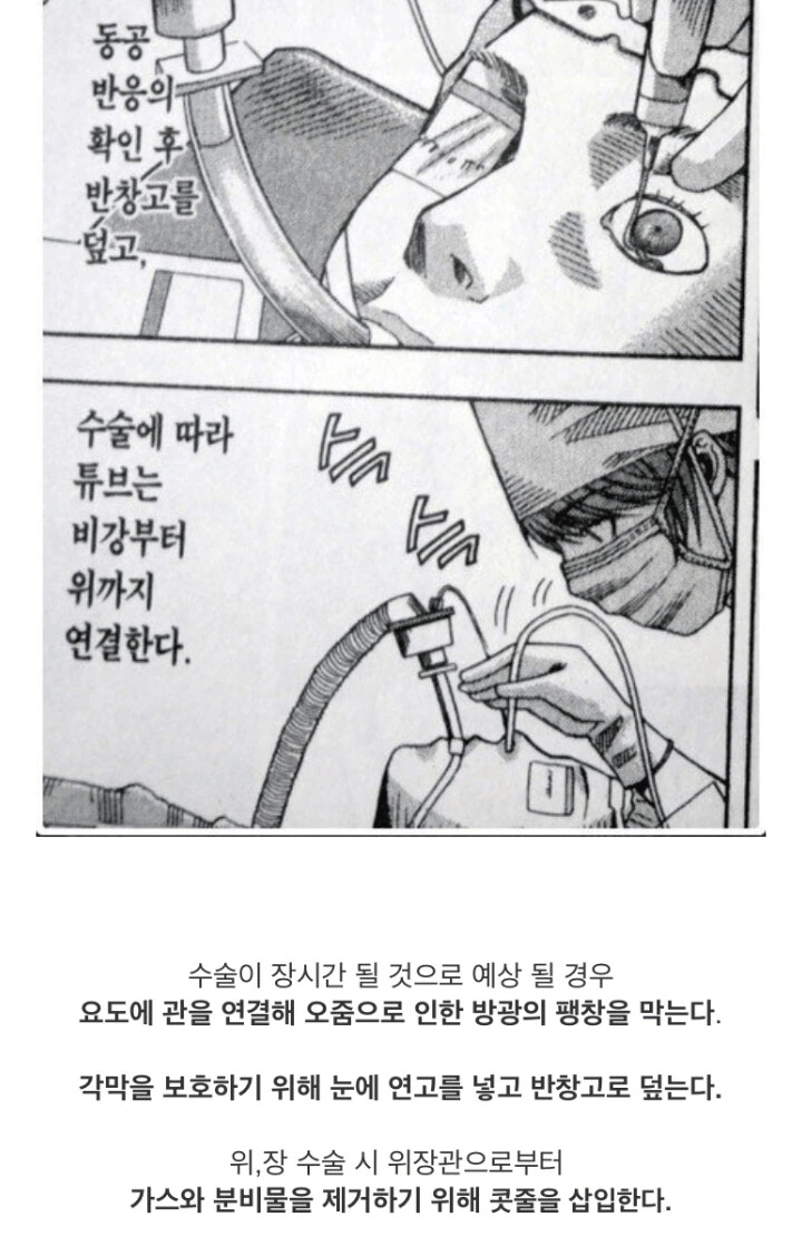 전신마취 알려주는.manga - 이미지 12