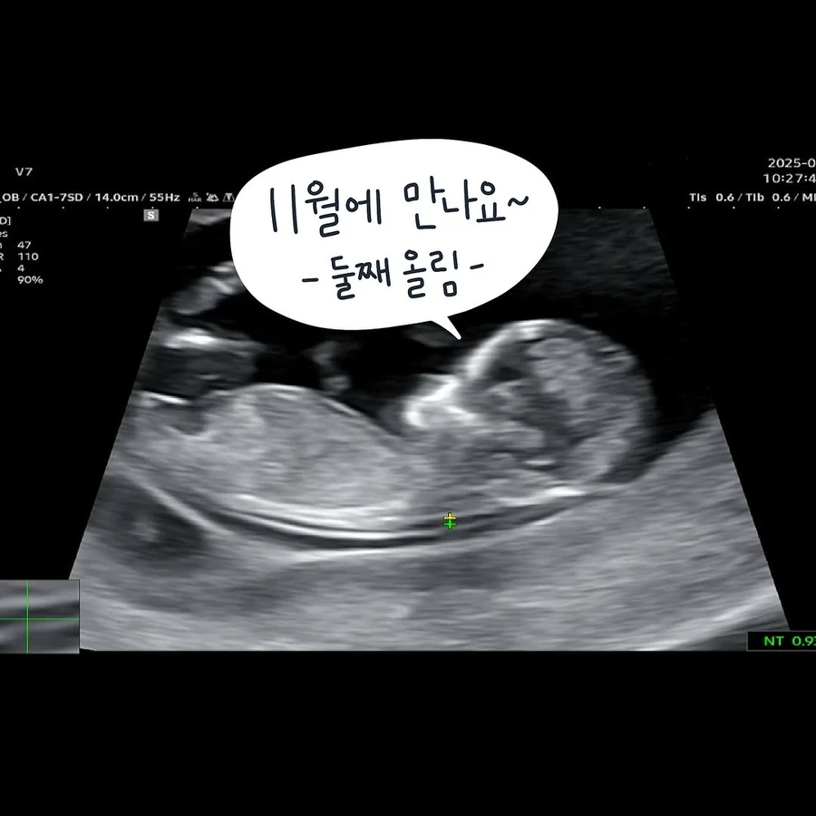남편이 ㅇㅅ기간내내 해준 일 .manhwa - 이미지 13
