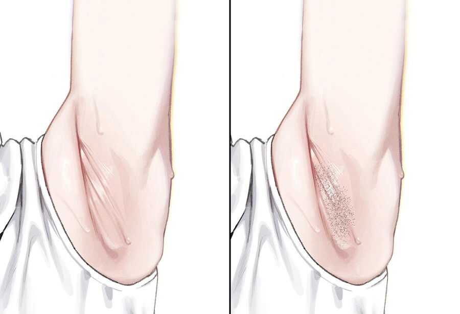 겨드랑이 호불호.jpg